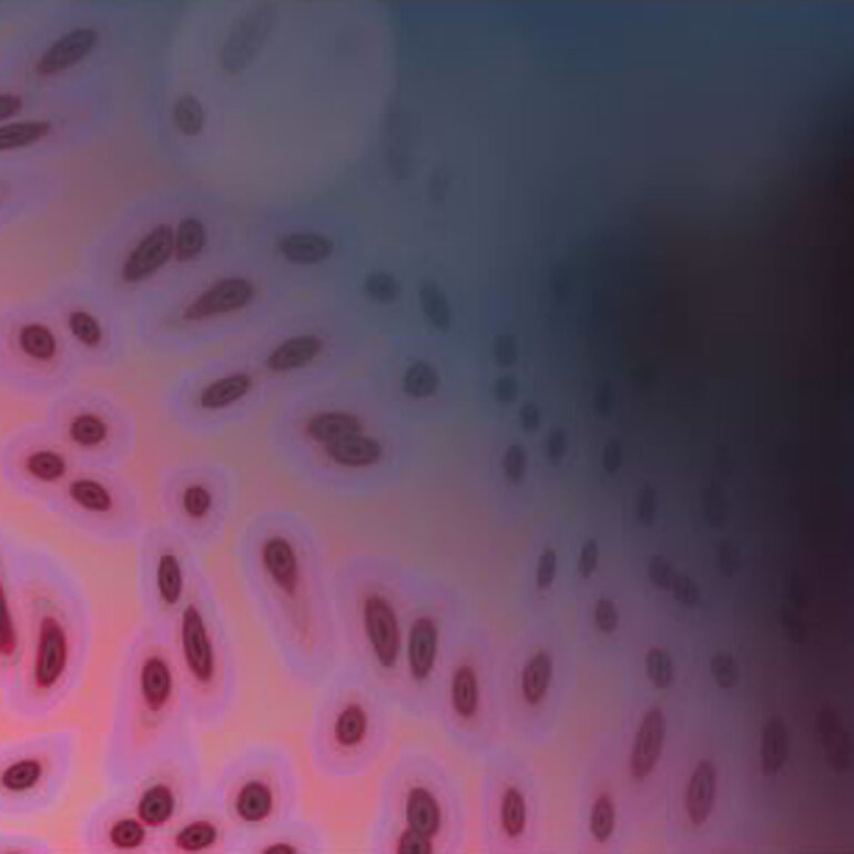 ESMO-Journals-Cancer-Treatment-Reviews-1000x1000