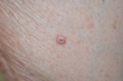 图片提供受Dr.V级西波德癌症大学学院Toulouse Oncopole-Force2014所有权利保留