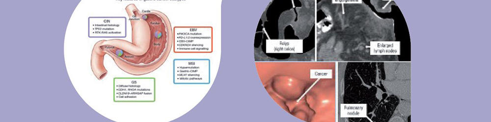2021 EMPO临床肠道纹理横幅